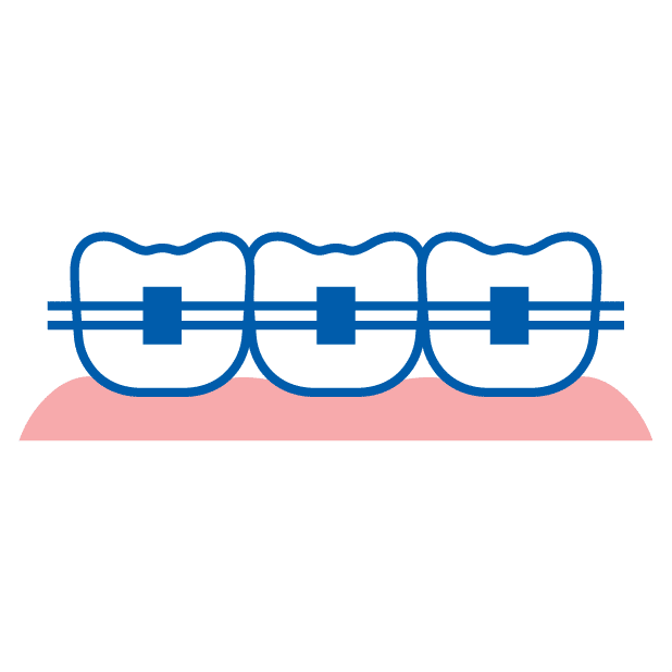 Ortodoncia Servicio Icono - Clinica Odontologica Proteccion Oral