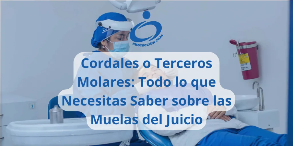 Cordales o Terceros Molares