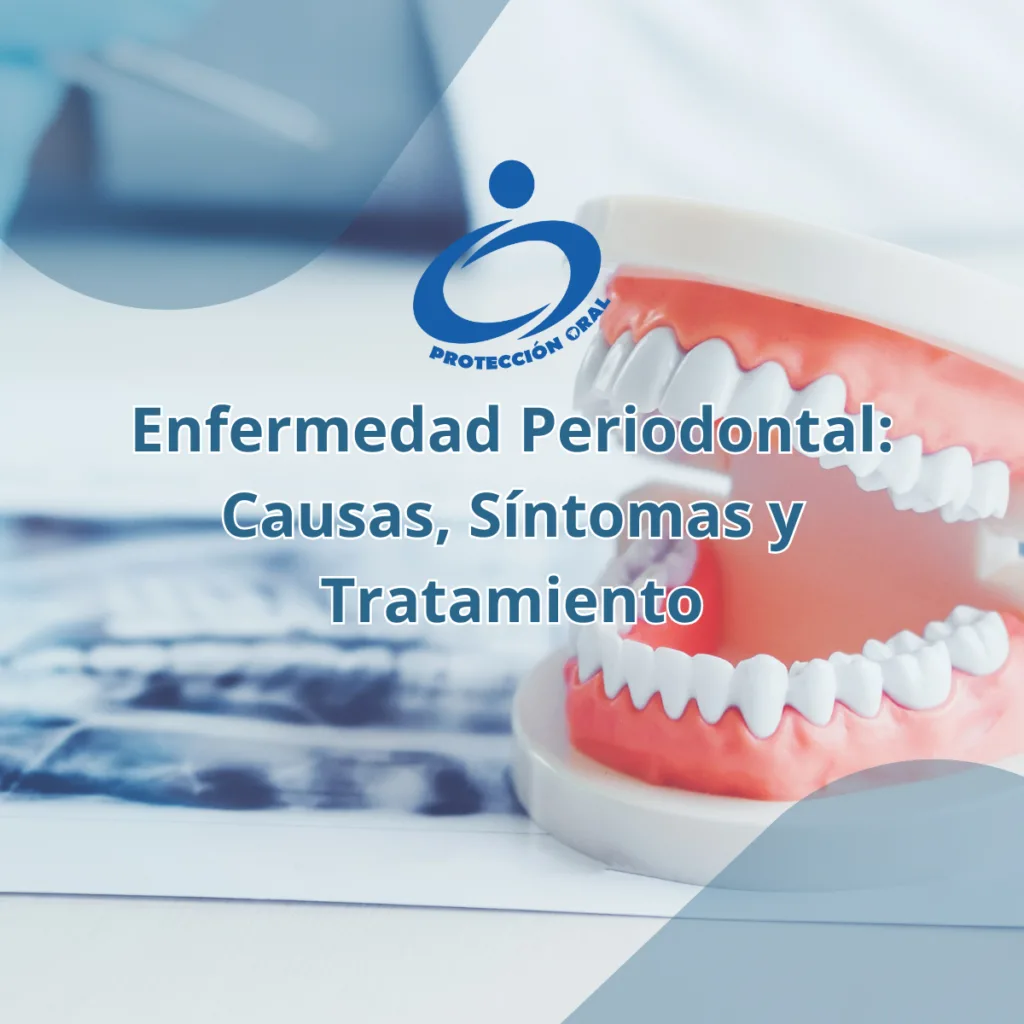 Tratamiento de enfermedad periodontal en Clínica Protección Oral