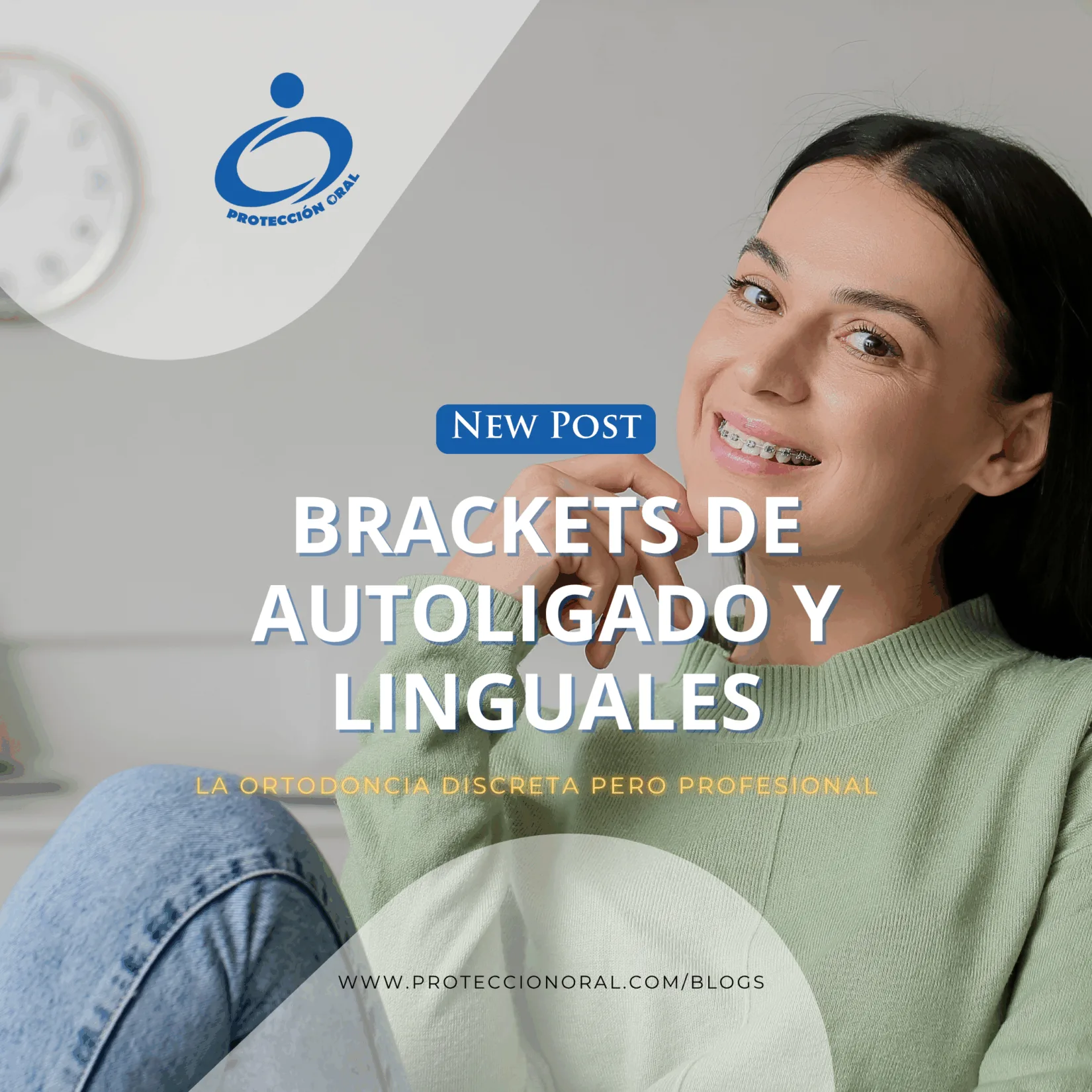 Brackets de Autoligado y Linguales: brackets estéticos Bogotá, ortodoncia discreta, brackets linguales precio, brackets de autoligado precio, brackets invisibles para adultos, ortodoncia lingual discreta.