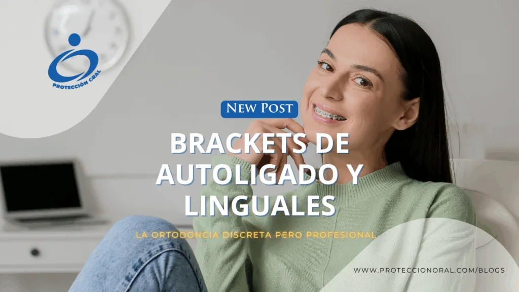 Brackets de Autoligado y Linguales: brackets estéticos Bogotá, ortodoncia discreta, brackets linguales precio, brackets de autoligado precio, brackets invisibles para adultos, ortodoncia lingual discreta en Bogotá