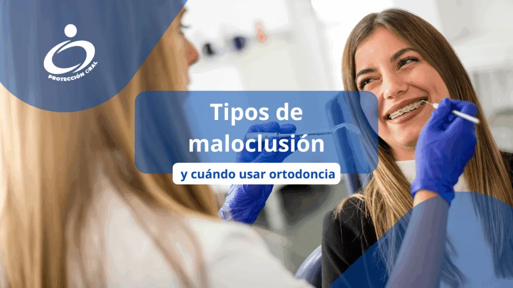 Tipos de maloclusión y cuándo usar ortodoncia: Brackets metálicos y estéticos usados en tratamiento de ortodoncia.