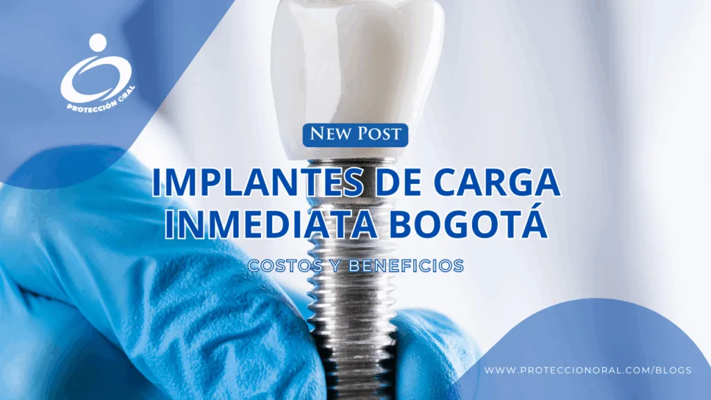 Implantes de carga inmediata en Bogotá: ¿Cuál es su verdadero costo y beneficios?