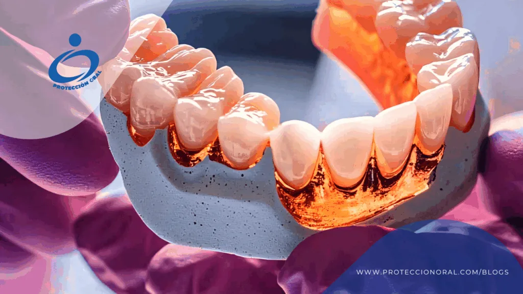Implantes dentales vs prótesis removibles, diferencias: estabilidad, estética y mantenimiento