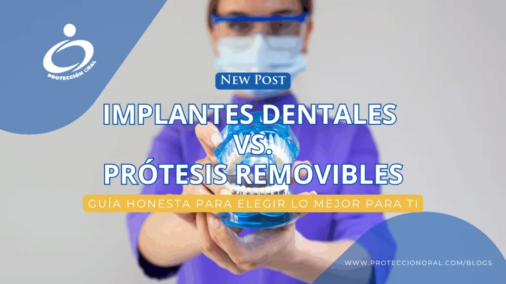 Comparativa de implantes dentales vs prótesis removibles en Bogotá – Protección Oral
