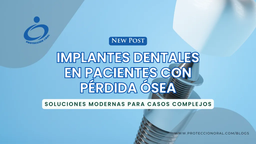 Implantes dentales en pérdida ósea: soluciones modernas en Bogotá