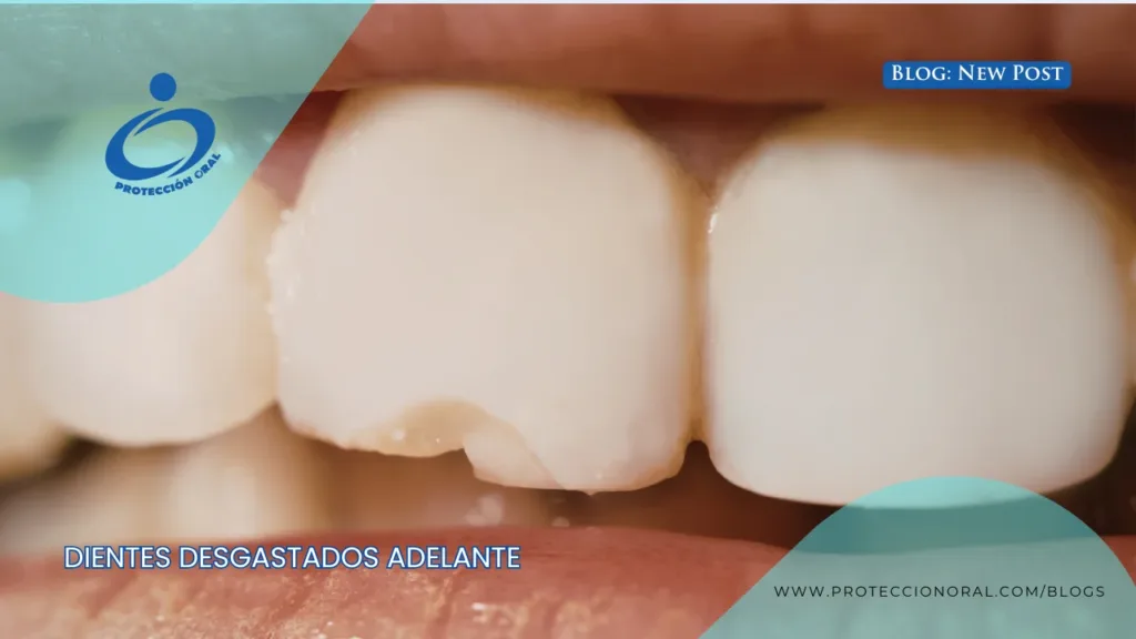 Desgaste dental en dientes frontales