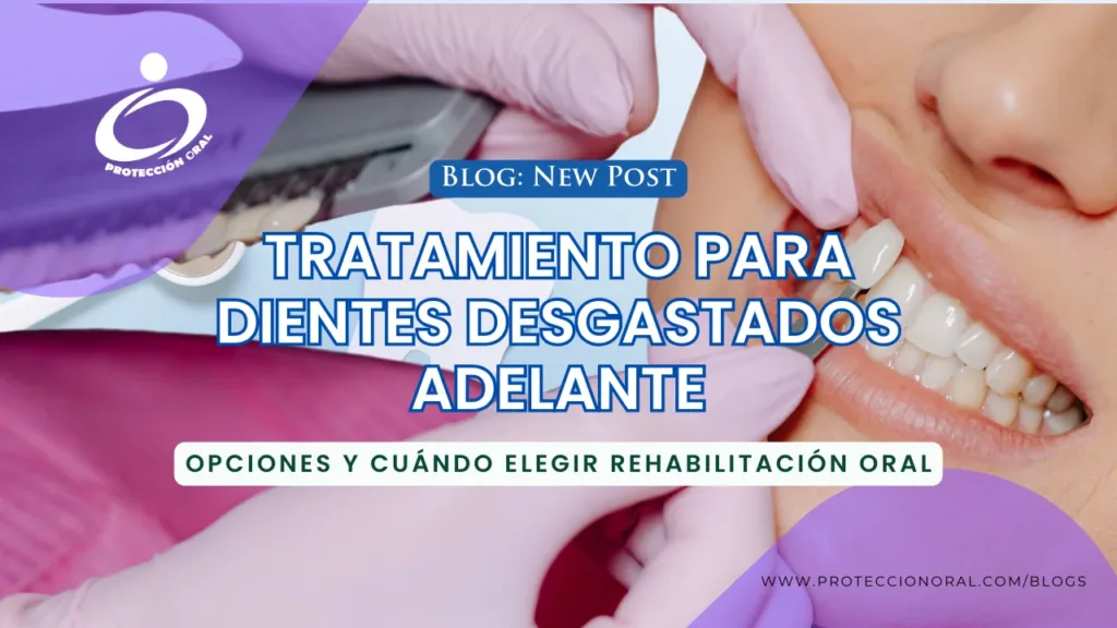 Tratamiento para dientes desgastados adelante